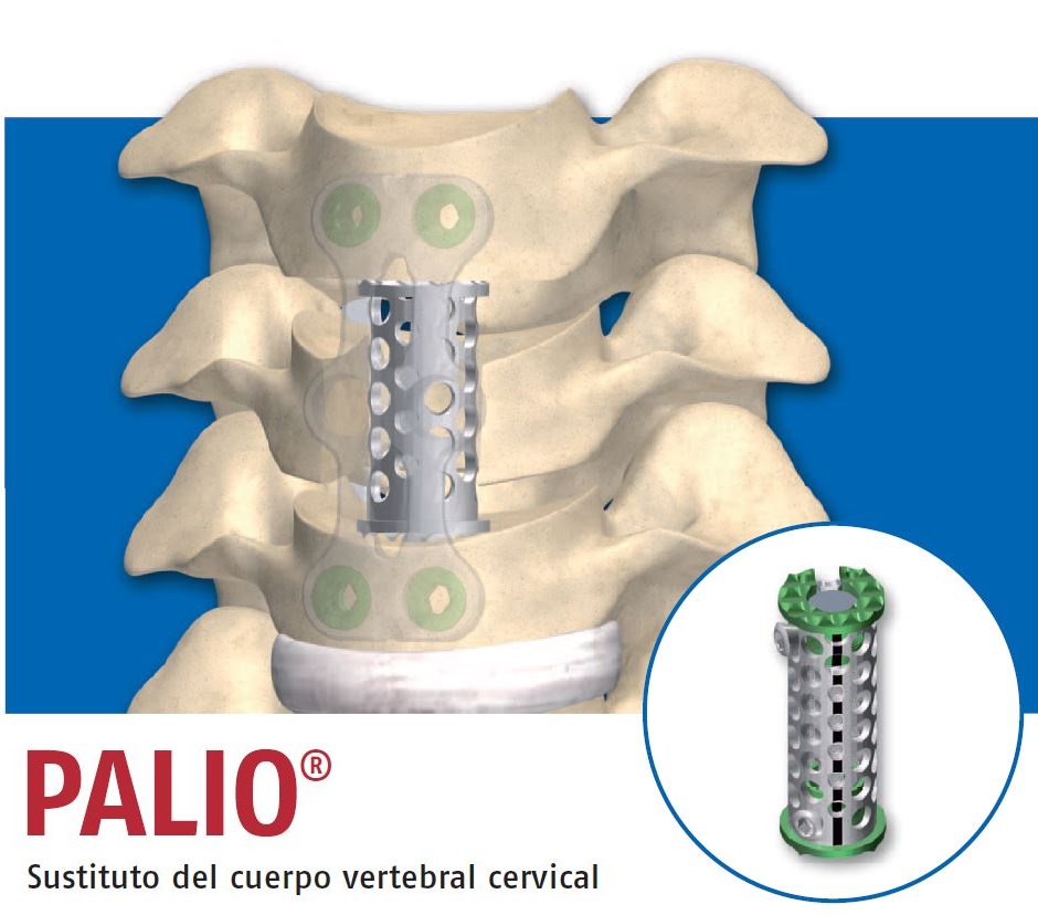 Palio - Image 4