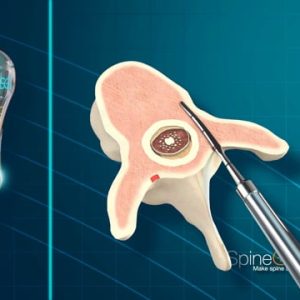 PediGuard