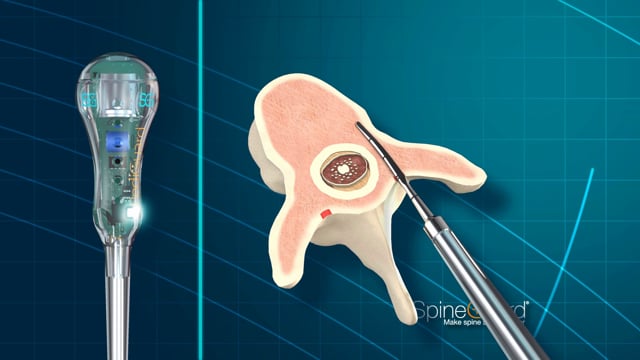 PediGuard